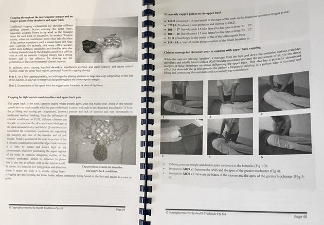 Modern Cupping Therapy workbook